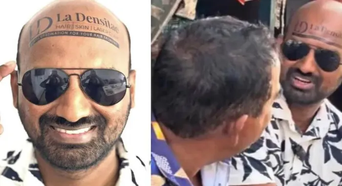 Shafeek Hashim Ads On Bald